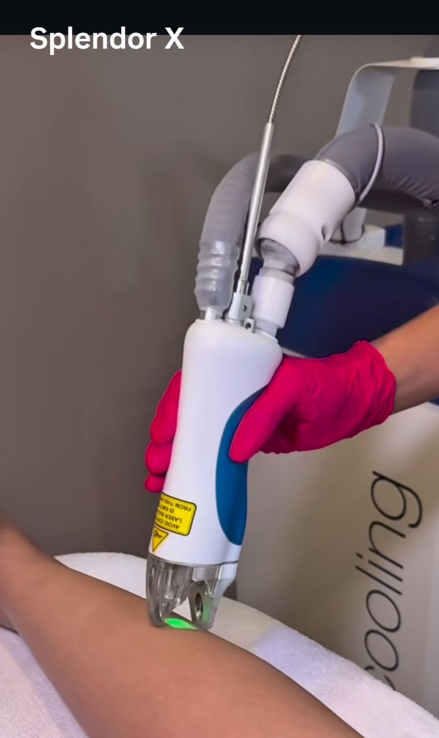 Lumenis Splendor X Compatible Laser Hair Removal Fiber – 755nm/1064nm Square Spot